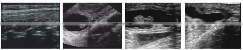 CE, ISO apprroved portable veterinary ultrasound machines for sale