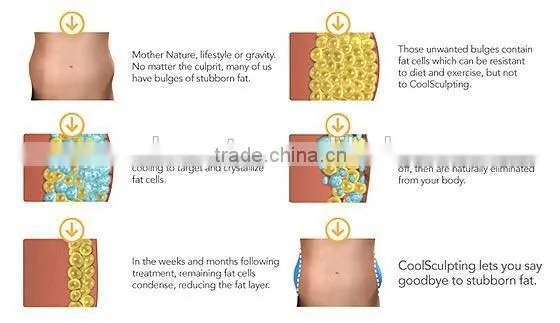 2013 Famous sculpting freezing fat loss & Cryo lipo laser slimming machine