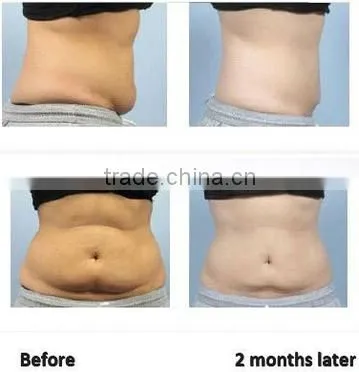 2014 best price and most effective 5 in 1 cavitation