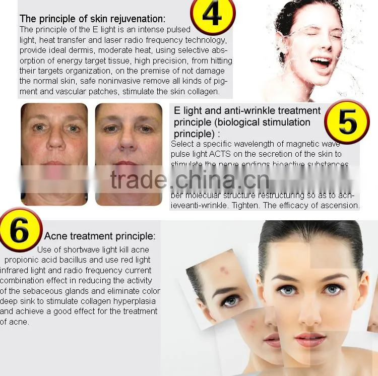 Factory Direct Sales IPL Laser Lair Removal Power Supply Photo Rejuvenation machine in Renlang Beauty Machine