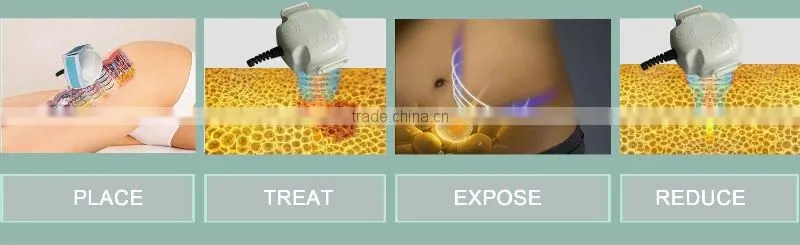 Potable Ultrasonic Slimming Machine Liposuction