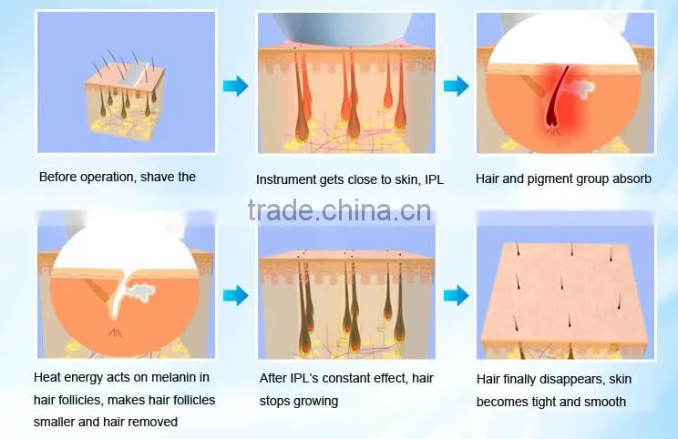 skin tester for Laser portable ipl hair removal device IPL machine with 300,000 shots lamp using life CE PSE ROHS approved