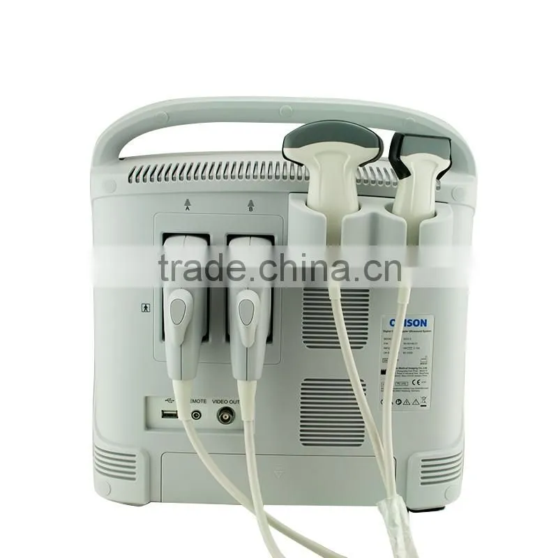 China cheap price USB portable laptop color doppler ultrasound scanner for pregnancy scanner ultrasound