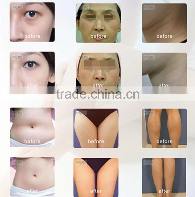 Advanced body slimming cavitation ultrasound beauty machine