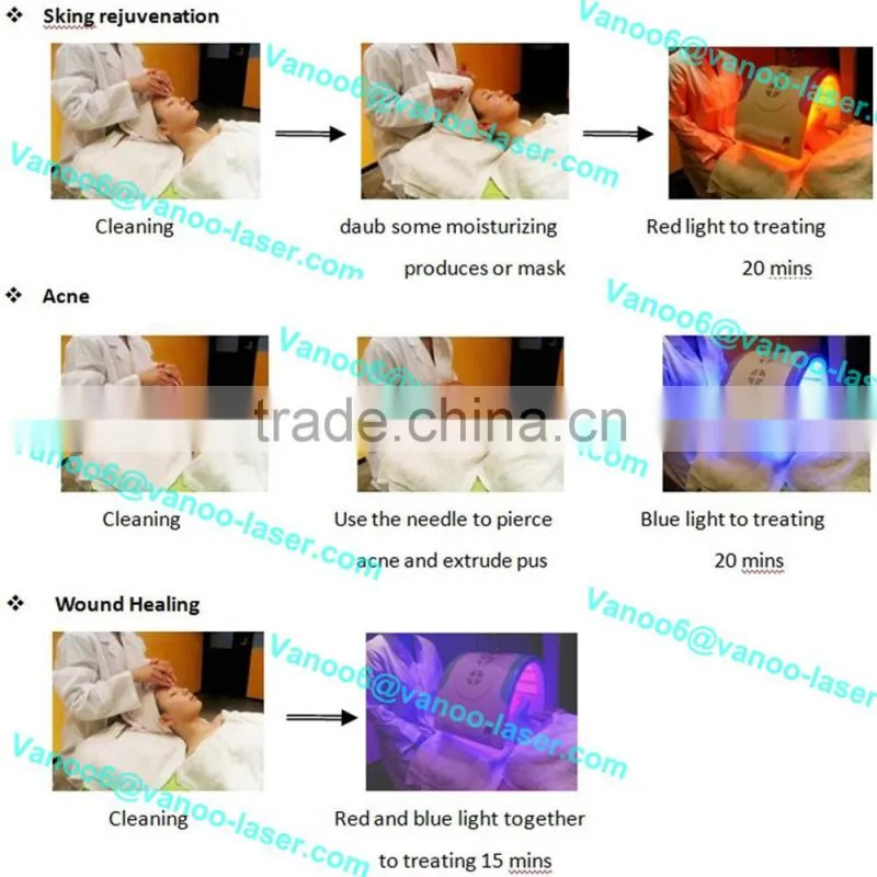 2016 Hottest PDT/LED therapeutic light/facial skin rejuvenation/acne removal machine/pore removal/sunspot removal