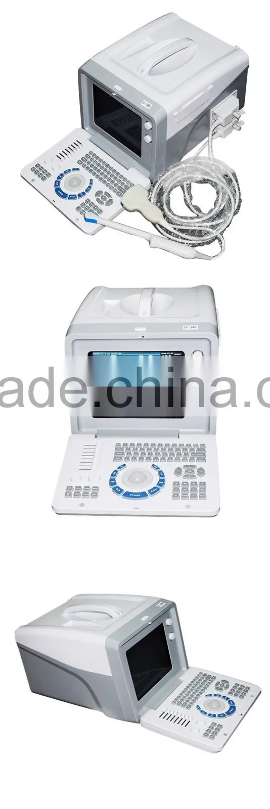 Medical hospital ultrasound diagnostic machine portable ultrasound equipment