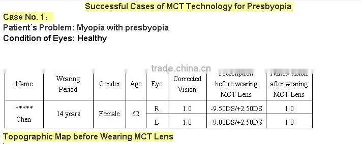 Digital Rigid contact lens for Presbyopia control / MCT/ Luxuriant metamorphosis of RGP Lenses