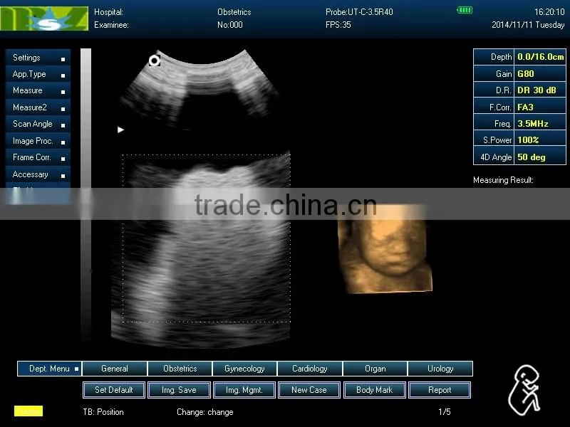 ultrasound machine ,ultrasound machine price,ultrasound scanner