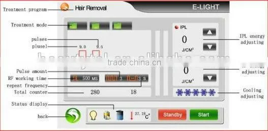 epilation machine