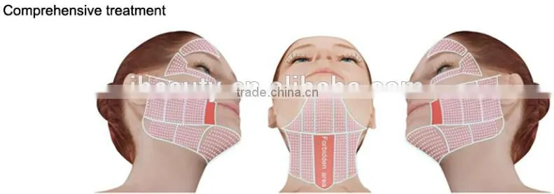 2015 professional portable HIFU High Intensity Focused Ultrasound HIFU with 3 tips for wrinkle removal