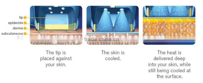 Facial beauty equipment rf fractional/fractional rf machine