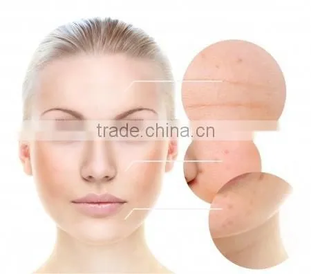 2015 New Products Red Light Therapy massage moxibustion treatment For Skin Whitening
