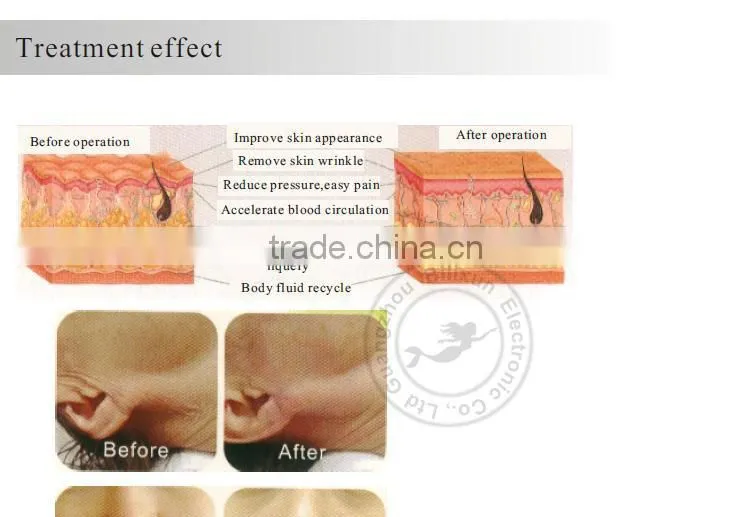 hotsale multipolar radio frequency rf facial machine FG-RF05