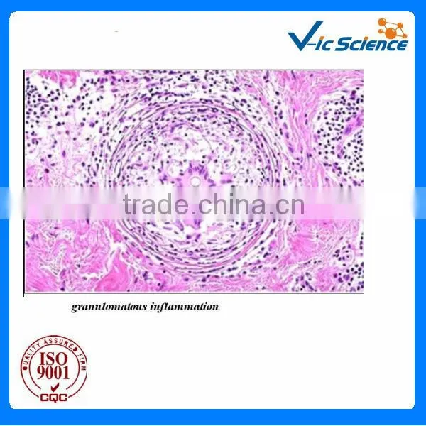 Lab survey human pathological prepared slides from factory