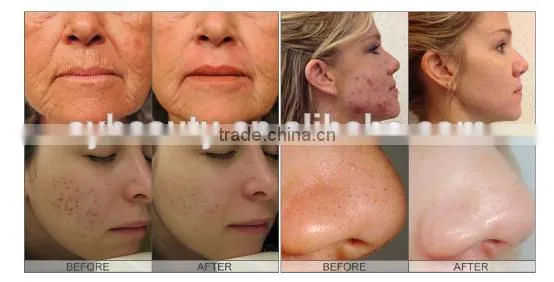 AYJ-X11B-C multifuction facial therapy spa equipment