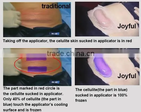 Portable Bio Skin rejuvenation Pressotherapy Slimming Machine