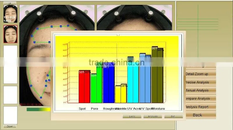 Portable facial skin analyzer machine with CE certification