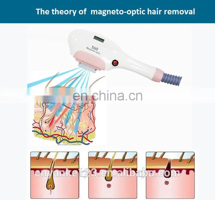 Best Portable 360 magneto-optic hair removal skin rejuvenation machine / opt shr e light hair removal machine price