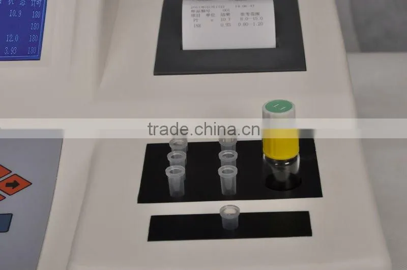 analyzing blood test results