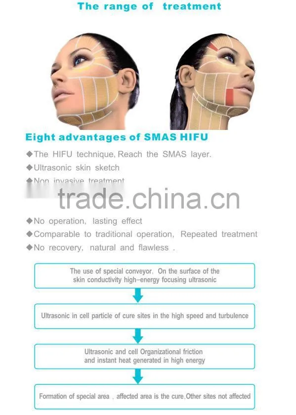 hifu/hifu machine/hifu face lift