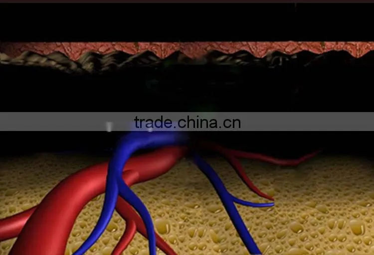 808nm medical diode 808nm laser hair removal laser spare parts
