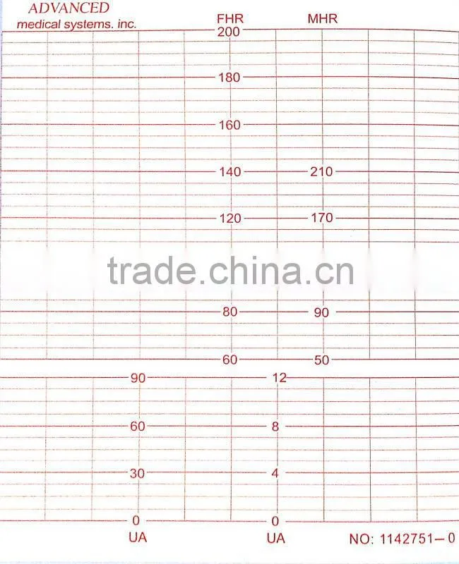 Fetal Monitor Paper / 120mm*100mm-150p Fetal Monitor Recording Paper for Advanced Medical System AM66