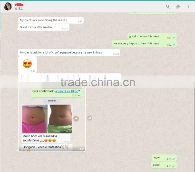 Spa use machine for body scupture fat removal slimming cryolipolise