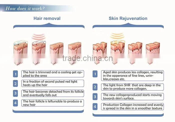 High Quality CE SHR 212 Opt Elight RF Beauty Machine With 2 Heads