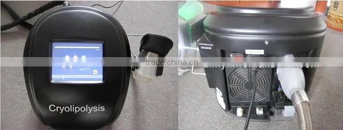 Cryolipolysis equipment/Portable cryolipolysis/mini cryolipolysis device