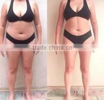 CE Cavitation slimming machine Rf freezing cavitation weight loss machine