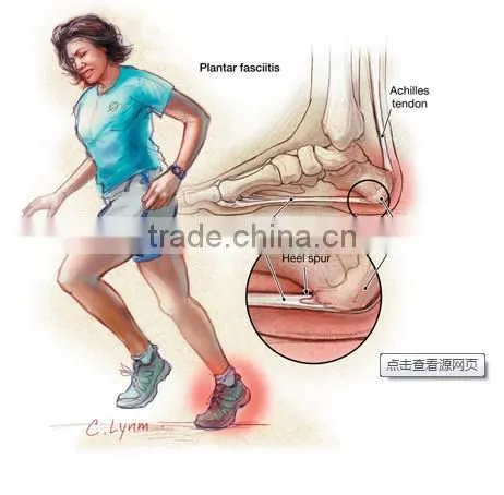 Herbal extract type Heel pain relief patch,foot patches