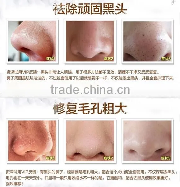 Japan Deeply Blackhead Removal Nose Strips