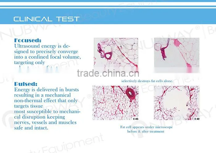 PROMOTION!New beauty for 2015 High Quality Ultrasonic wave slim HIFU Slimming machine