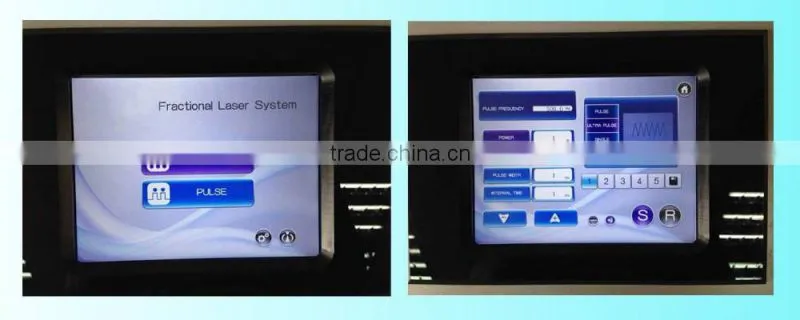 2016 medical equipment wrinkle & scar removal co2 fractional laser/ fractional CO2 vaginal removal
