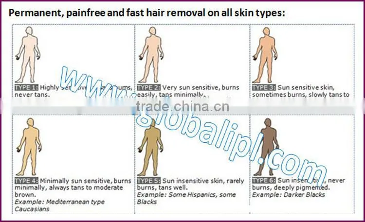 2016 Alibaba China new technology/Permanent/Hair removal/alexandrite hair removal machine