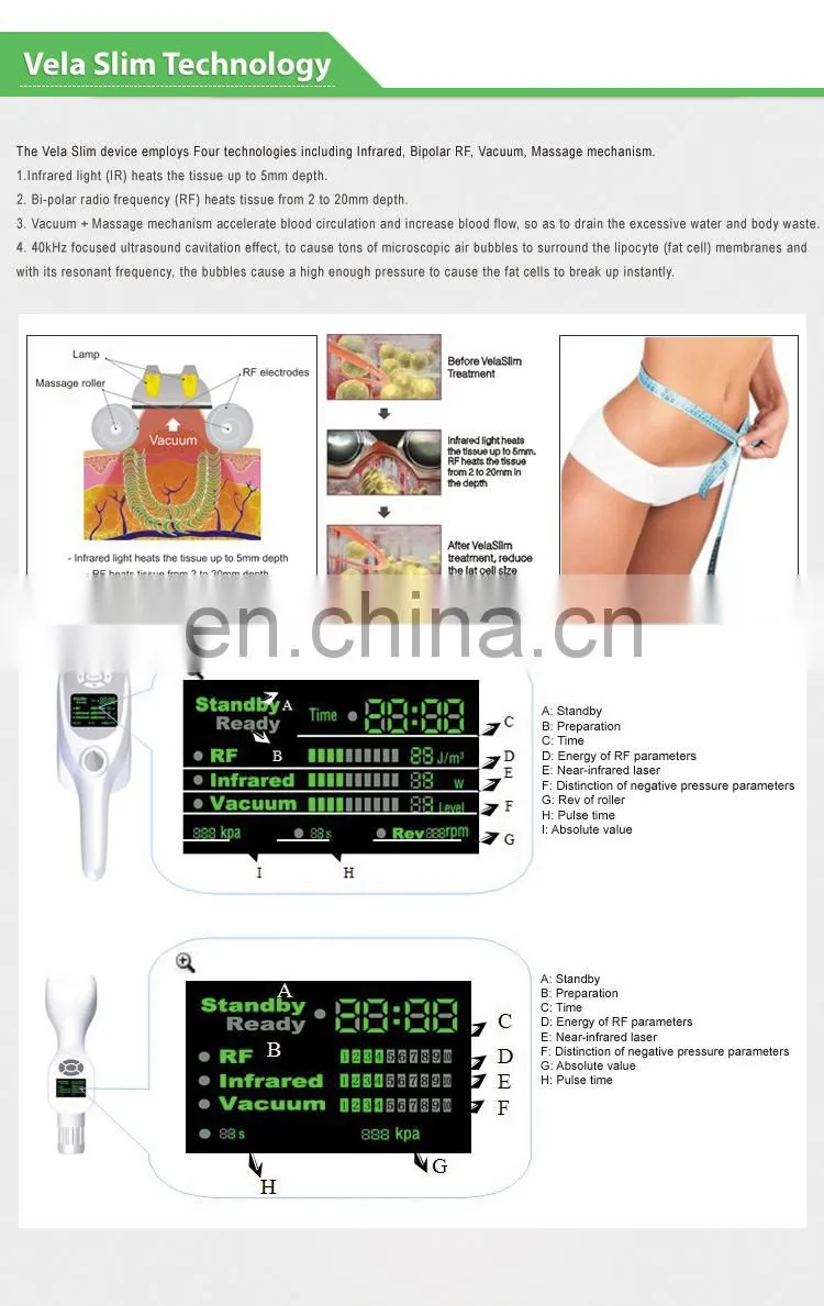 Professional vela slimming shape machine/vela slim sculptor/vela slim cellulite