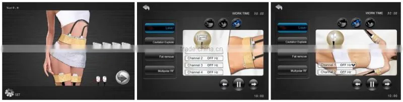 Cavitation Vacuum RF Laser beauty machine for cellulite reduction