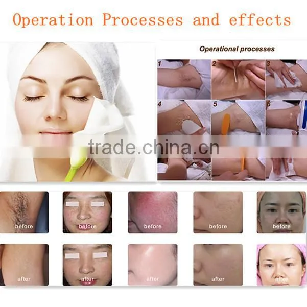 Professional OPT SHR system portable hair removal machine