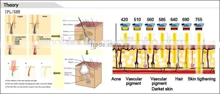 Big discount imported lamp two handles 3000w 1-10hz shr hair removal weifang ipl