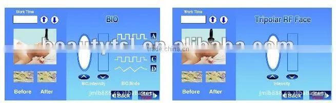 RF Vacuum Cavitation Slimming Machine