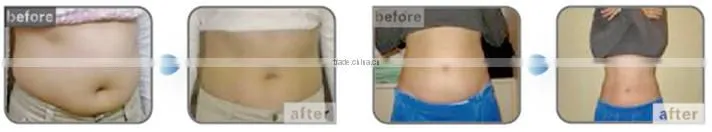 Trade assurance! 5 handles cryolypolisis freezing equipment cool shape fat freezing machine