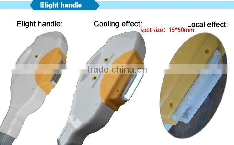 IPL lamp 150000 shots in high quality/ipl xenon laser flash lamp