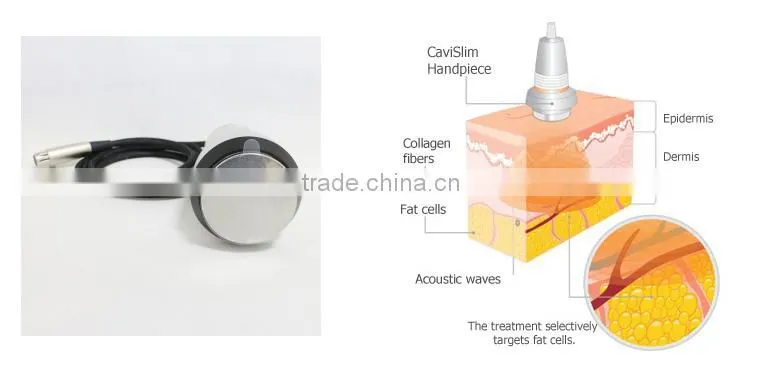 portable cavitation rf lipo machine for home