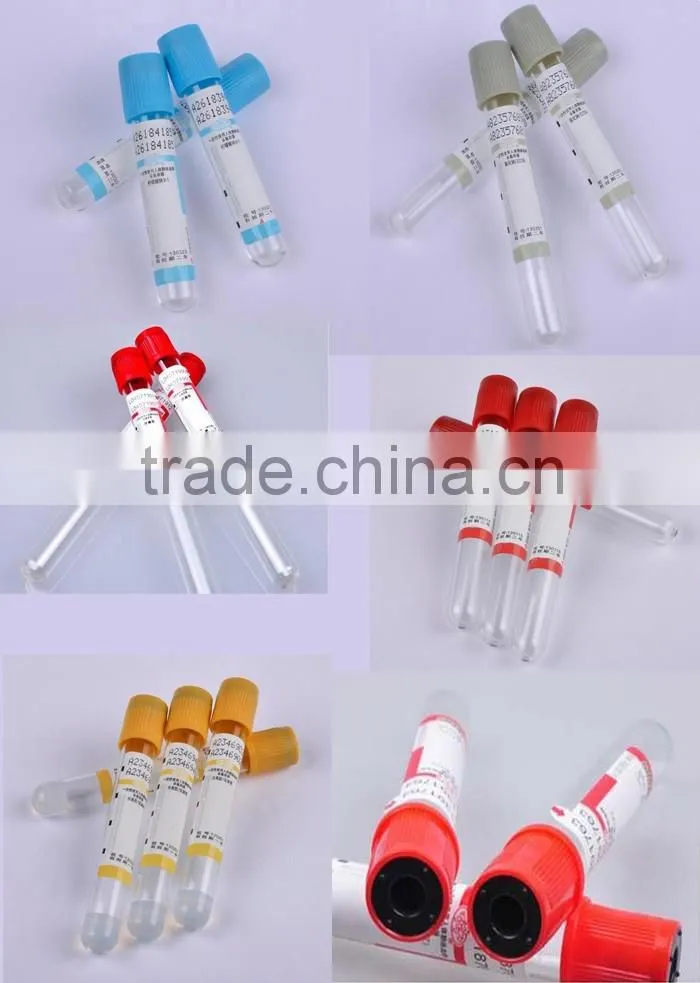 Blood collection tube sodium citrate