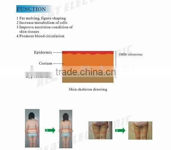 Guangzhou HETA HOT! Cryolipolysis Lipo sculpting cavitation RF/Cryo laser liposuction equipment