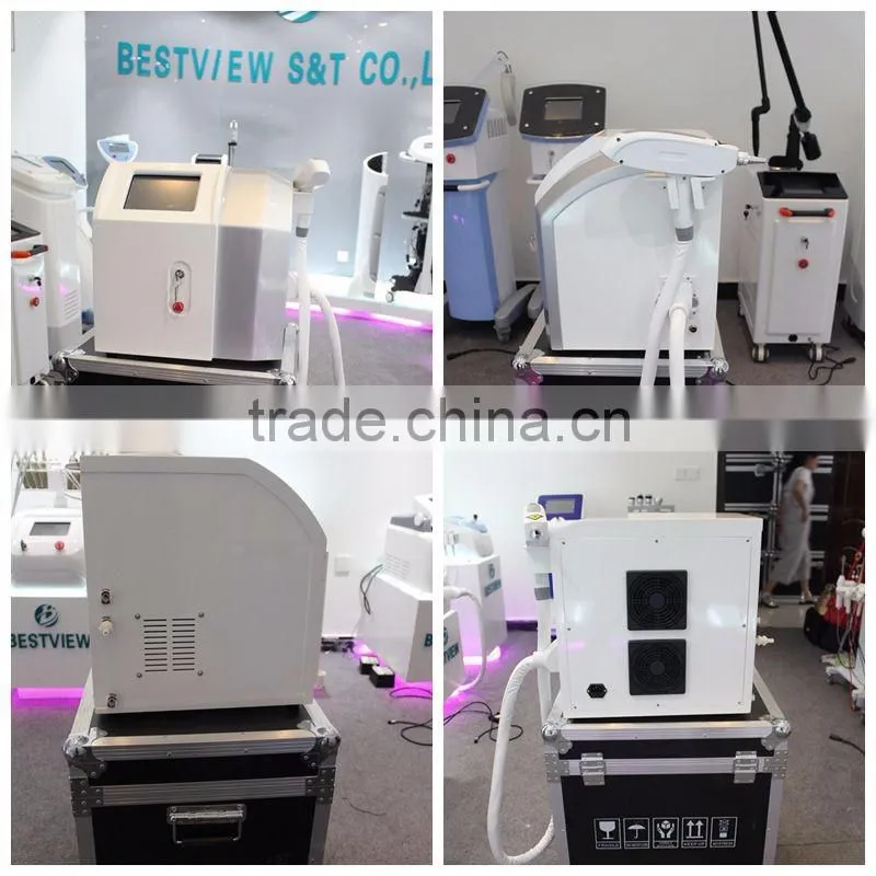 Bestview factory supply Tattoo Removal Equipment q-switch nd yag laser