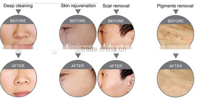 2016 Face Skin Rejuvenation Oxygen Machine for Skin Care with 98% pure