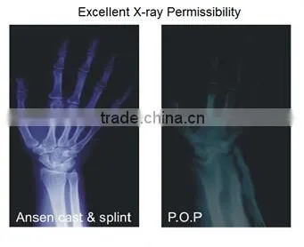 High Rigidness Fast Hardening Medical Polyester Orthopedic Cast Socket/Sleeve Casting