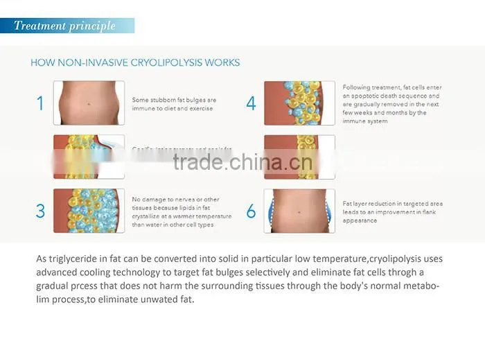Ultrasonic cavitation rf slimming device body slimming machine for sale