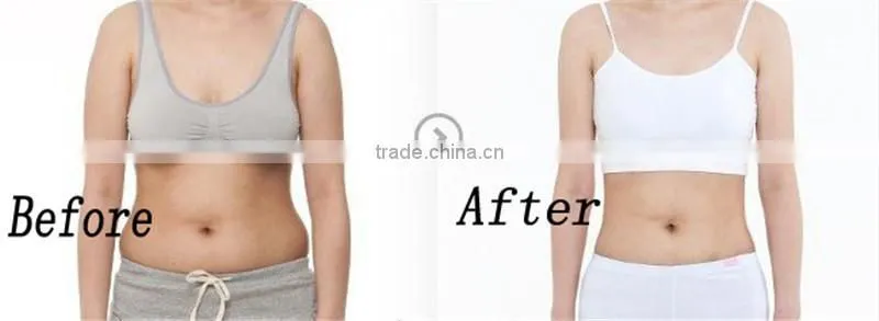 Manufacturer for cool tech fat freezing machine